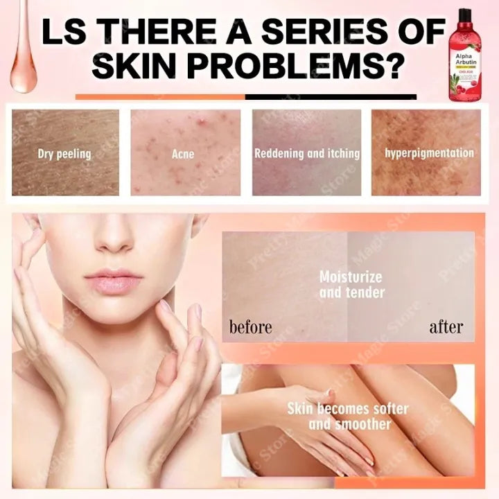 BUY 1 TAKE 1 Alpha Arbutin Body Serum 500ml For Skin Whitening Skin Care Essence Moisturizer Dark Spot Whitening Face & Body Serum Whitening Niacinamide To Improve Dull Skin