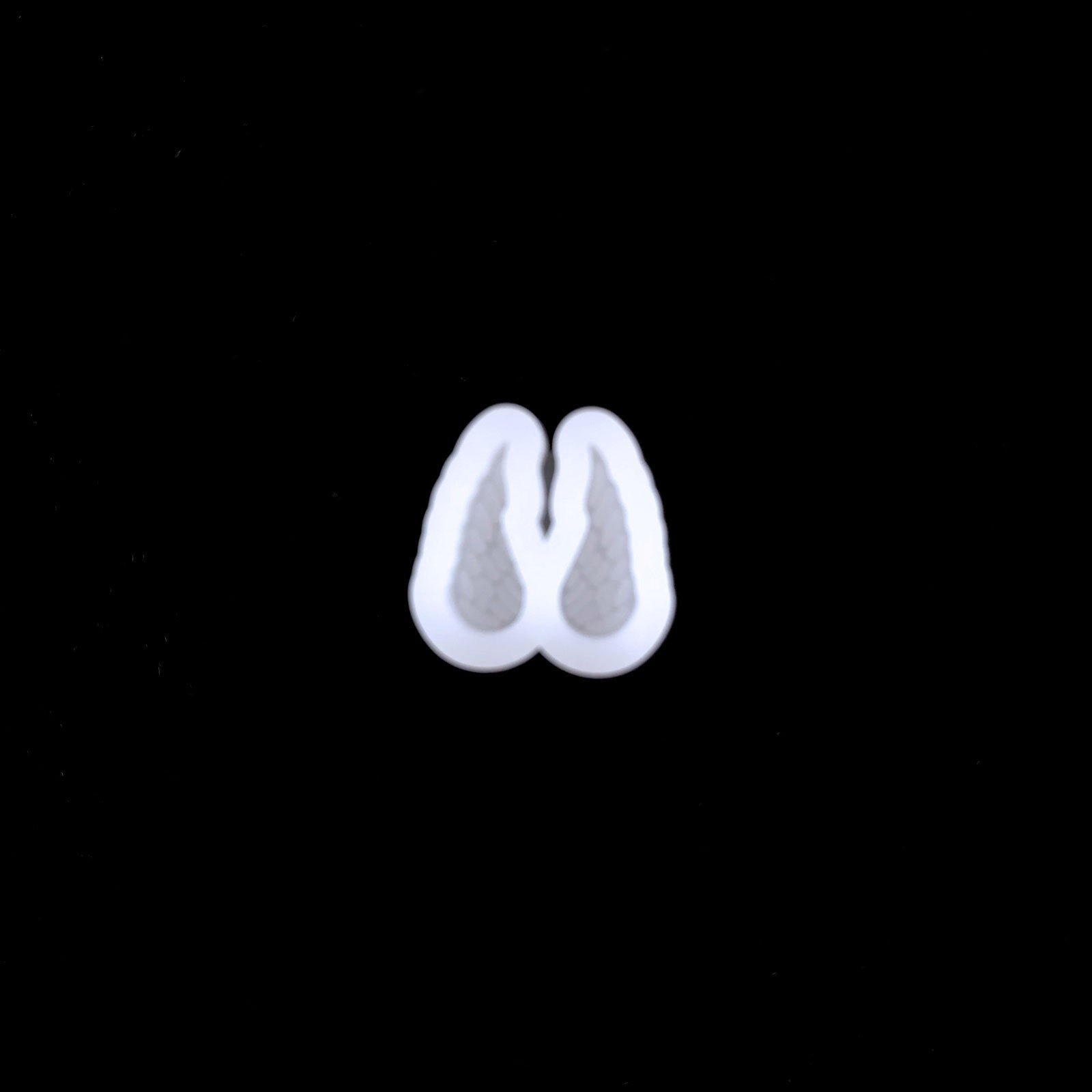 d5c212d12e36bdbade135f8c0e45dc3c
