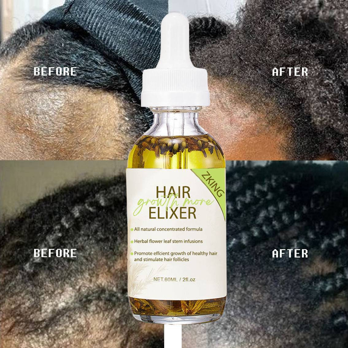 Private Label Natural Organic Repair Hair Growth Oil Moisturizing Avocado Olive Castor Rosemary Hair Growth Serum Oil
